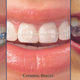 Illustration for article titled Steps Followed For The Best Orthodontic treatment Process At Growing Smiles